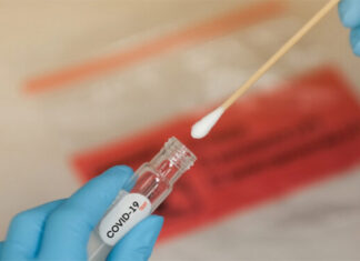 El 41% de pruebas de Covid-19 realizadas en el triaje municipal de SPS en los últimos 8 días dieron positivo