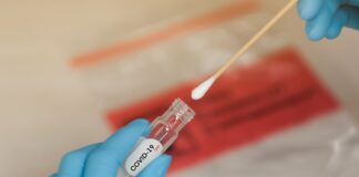 El IHSS abre proceso de ofertas para la compra directa de pruebas rápidas para detectar Covid-19