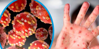 La OMS espera que en 2023 se produzca una reducción significativa de covid y viruela del mono