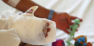 Un menor ingresó al Hospital Escuela con quemaduras por pólvora