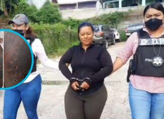 Dictan auto de formal procesamiento con prisión preventiva contra mujer que quemó a su hija con una plancha