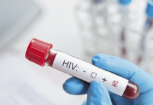 El sida mató a 650,000 personas en 2021, un 5,79% menos que el año anterior