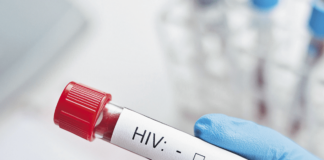 El sida mató a 650,000 personas en 2021, un 5,79% menos que el año anterior