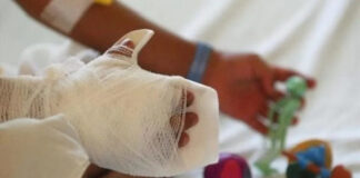 Fundaniquem reporta una ocupación del 40 % de menores quemados con pólvora al inicio de la temporada navideña