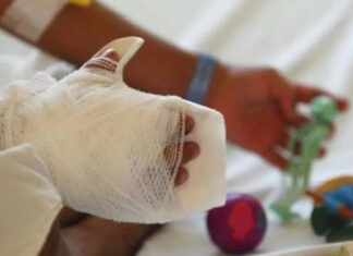 Fundaniquem reporta una ocupación del 40 % de menores quemados con pólvora al inicio de la temporada navideña