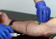 Un nuevo análisis de sangre detecta el alzhéimer antes de los primeros síntomas