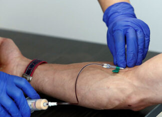 Un nuevo análisis de sangre detecta el alzhéimer antes de los primeros síntomas