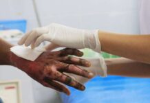 Entre 3 y 4 niños ingresan semanalmente con quemaduras al Hospital Escuela