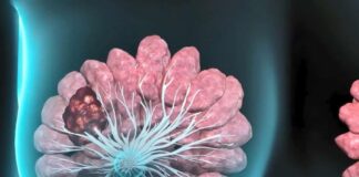 Cáncer de mama: nuevo método para buscar el mejor fármaco para cada paciente