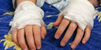 Ingresa a Fundaniquem una menor con quemaduras por pólvora