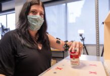 La neuroestimulación devuelve la movilidad en el brazo a 2 pacientes de ictus