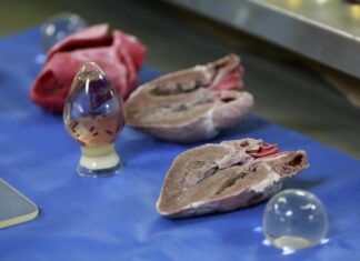 La donación de órganos en México aumentó un 40 % en 2022