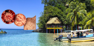 Islas de la Bahía registra el primer caso de viruela símica