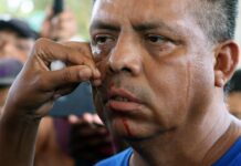 Migrantes en caravana se suturan labios para presionar a Migración de México