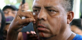 Migrantes en caravana se suturan labios para presionar a Migración de México