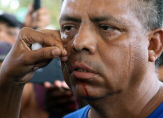 Migrantes en caravana se suturan labios para presionar a Migración de México