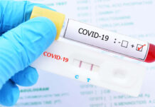 Doctor Omar Videa muestra preocupación ante el aumento de casos positivos por Covid-19 en el país