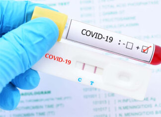 Doctor Omar Videa muestra preocupación ante el aumento de casos positivos por Covid-19 en el país