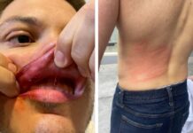 Colectivos de Libre me agredieron, tengo golpes en todo el cuerpo, sostiene Rashid Mejía