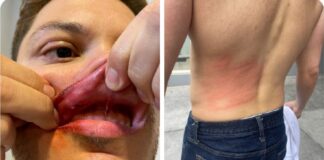 Colectivos de Libre me agredieron, tengo golpes en todo el cuerpo, sostiene Rashid Mejía