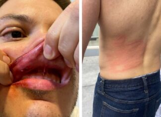 Colectivos de Libre me agredieron, tengo golpes en todo el cuerpo, sostiene Rashid Mejía
