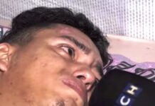 HCH y el pueblo hondureño logran recaudar más de 300 mil lempiras para hospitalizar a joven motociclista que fue arrollado por un celoso hombre en San Pedro Sula