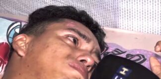 HCH y el pueblo hondureño logran recaudar más de 300 mil lempiras para hospitalizar a joven motociclista que fue arrollado por un celoso hombre en San Pedro Sula