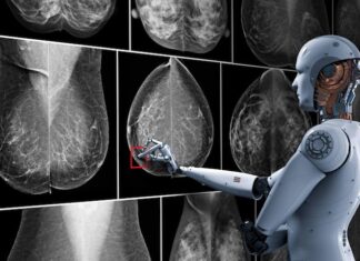 La Inteligencia Artificial permitirá avanzar hacia un tratamiento menos invasivo del cáncer de mama