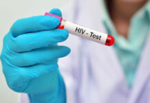 Conadeh: «Gobiernos municipales deben dejar de solicitar pruebas de VIH a quienes contraerán nupcias»