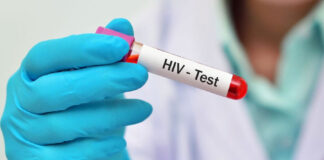 Conadeh: «Gobiernos municipales deben dejar de solicitar pruebas de VIH a quienes contraerán nupcias»