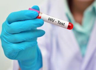 Honduras registra 43.190 casos de VIH desde 1985, con 875 nuevas infecciones en 2024