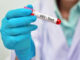 Honduras registra 43.190 casos de VIH desde 1985, con 875 nuevas infecciones en 2024