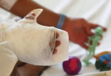 Unos 25 niños han sido afectados por quemaduras en el 2024, reporta el CEHNIQ