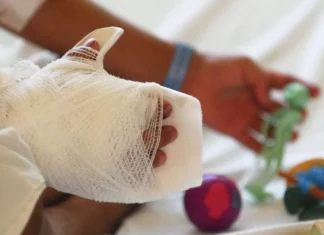 Cinco menores ingresados de emergencia por quemaduras de pólvora en Honduras