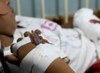 Aumentan a 35 los casos de menores quemados pólvora durante la temporada navideña y de fin de año en Honduras