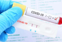 Perú suma 15 fallecidos por COVID-19 en lo que va del año, informa el ministro de Salud