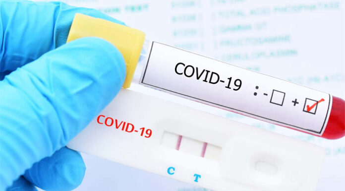 Perú suma 15 fallecidos por COVID-19 en lo que va del año, informa el ministro de Salud