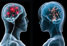 La Inteligencia Artificial identifica que los cerebros de hombres y mujeres se organizan de forma diferente