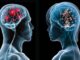 La Inteligencia Artificial identifica que los cerebros de hombres y mujeres se organizan de forma diferente