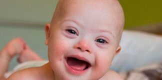 Bebés con síndrome de Down eran enterrados con un estatus especial en la Edad del Hierro