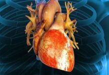 El ayuno intermitente dispara un 91% el riesgo de muerte por enfermedad cardiovascular