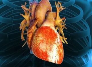 El ayuno intermitente dispara un 91% el riesgo de muerte por enfermedad cardiovascular