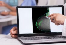 Identifican una nueva diana teraupeútica contra el cáncer de mama