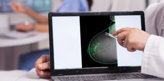Identifican una nueva diana teraupeútica contra el cáncer de mama