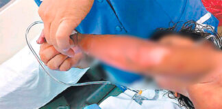 Otras dos niñas misquitas quemadas en incendio son trasladadas a Tegucigalpa