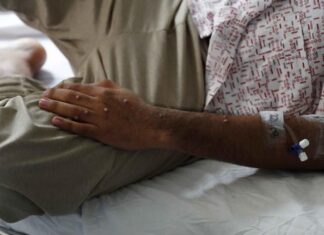 La OMS advierte sobre la transmisión del mpox, con casos notificados en 26 países este mes