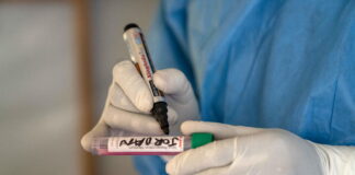 Honduras instala salas de vigilancia epidemiológica para detectar posibles casos de mpox