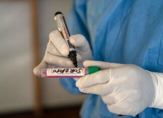 Honduras instala salas de vigilancia epidemiológica para detectar posibles casos de mpox