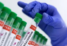 La OMS espera comenzar las vacunaciones contra la mpox en la RDC el fin de semana