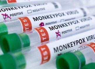 Marruecos registra el primer caso confirmado de mpox